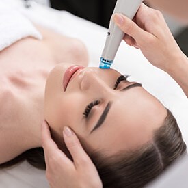 Hyperpigmentation Laser Treatment Streamwood